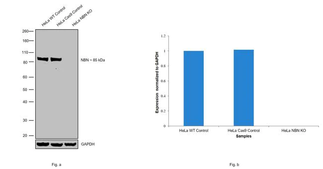Western blot - Anti-p95/NBS1 Antibody [RP23040230] (AB313492)