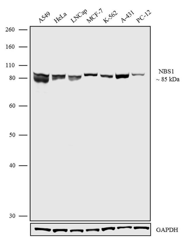 Western blot - Anti-p95/NBS1 Antibody [RP23040230] (AB313492), expandable thumbnail