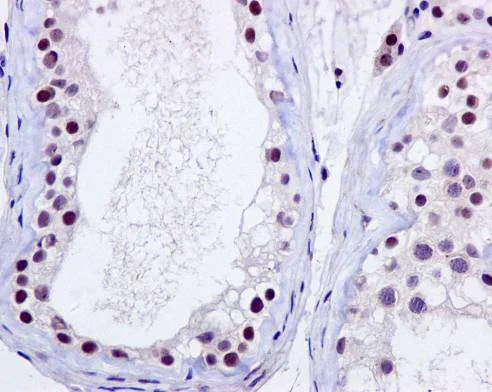 Immunohistochemistry (Formalin/PFA-fixed paraffin-embedded sections) - Anti-p95/NBS1 antibody [Y112] (AB32074)