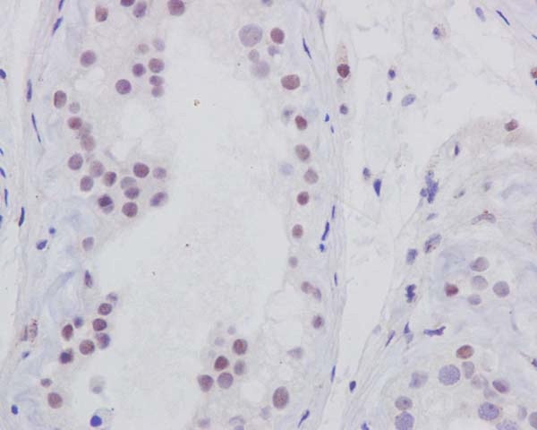 Immunohistochemistry (Formalin/PFA-fixed paraffin-embedded sections) - Anti-p95/NBS1 antibody [Y112] (AB32074), expandable thumbnail