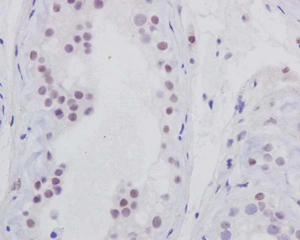 Immunohistochemistry (Formalin/PFA-fixed paraffin-embedded sections) - Anti-p95/NBS1 antibody [Y112] (AB32074)
