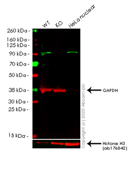 Western blot - Anti-p95/NBS1 antibody [Y112] (AB32074), expandable thumbnail