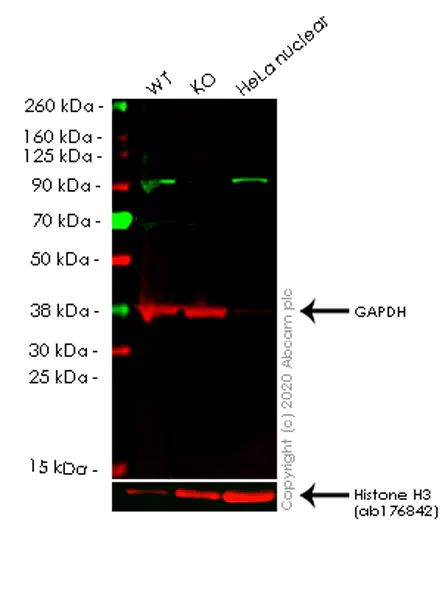 Western blot - Anti-p95/NBS1 antibody [Y112] (AB32074)