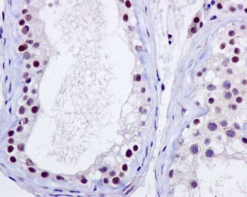 Immunohistochemistry (Formalin/PFA-fixed paraffin-embedded sections) - Anti-p95/NBS1 antibody [Y112] - BSA and Azide free (AB220217)