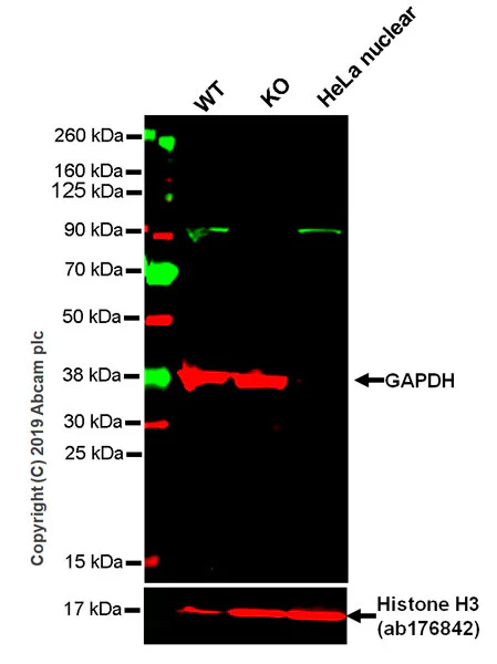Western blot - Anti-p95/NBS1 antibody [Y112] - BSA and Azide free (AB220217)