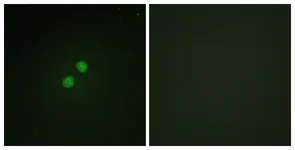 Immunocytochemistry/ Immunofluorescence - Anti-p95/NBS1 (phospho S278) antibody (AB111373)