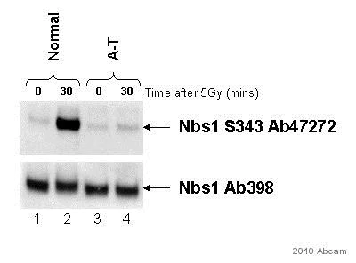 Western blot - Anti-p95/NBS1 (phospho S343) antibody (AB47272)