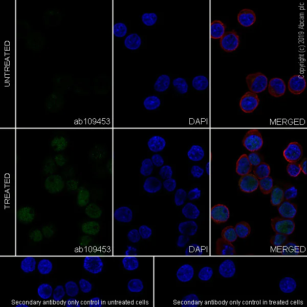 Immunocytochemistry/ Immunofluorescence - Anti-p95/NBS1 (phospho S343) antibody [EP178] - BSA and Azide free (AB226066)