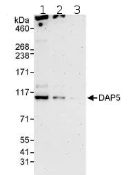 Western blot - Anti-P97/DAP5 antibody (AB85963)