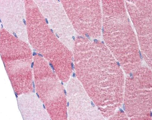 Immunohistochemistry (Formalin/PFA-fixed paraffin-embedded sections) - Anti-P97/DAP5 antibody (AB97302)