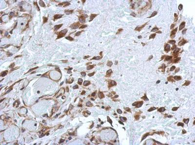 Immunohistochemistry (Formalin/PFA-fixed paraffin-embedded sections) - Anti-PABP antibody (AB153930), expandable thumbnail