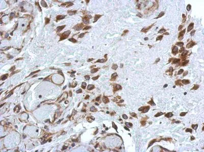 Immunohistochemistry (Formalin/PFA-fixed paraffin-embedded sections) - Anti-PABP antibody (AB153930)