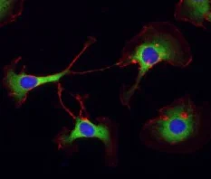 Immunocytochemistry/ Immunofluorescence - Anti-PABP antibody (AB21060)