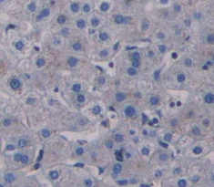 Immunohistochemistry (Formalin/PFA-fixed paraffin-embedded sections) - Anti-PABPC1L antibody (AB233280)