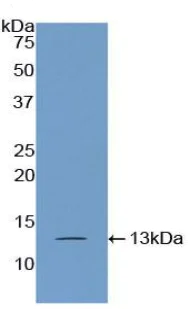 Western blot - Anti-PABPC1L antibody (AB233280)