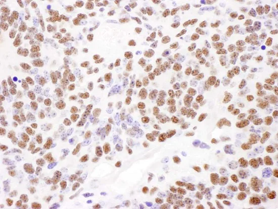 Immunohistochemistry (Formalin/PFA-fixed paraffin-embedded sections) - Anti-PABPN1 antibody (AB241477)