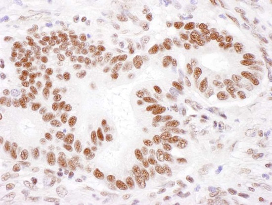 Immunohistochemistry (Formalin/PFA-fixed paraffin-embedded sections) - Anti-PABPN1 antibody (AB241477)