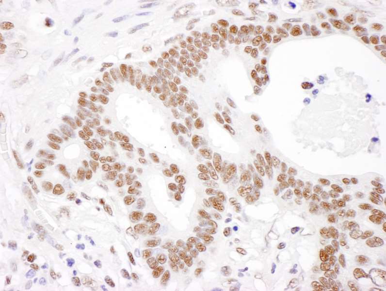Immunohistochemistry (Formalin/PFA-fixed paraffin-embedded sections) - Anti-PABPN1 antibody (AB264328)