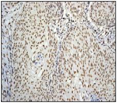 Immunohistochemistry (Formalin/PFA-fixed paraffin-embedded sections) - Anti-PABPN1 antibody [EP3000Y] - BSA and Azide free (AB232513)