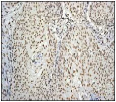 Immunohistochemistry (Formalin/PFA-fixed paraffin-embedded sections) - Anti-PABPN1 antibody [EP3000Y] - BSA and Azide free (AB232513)