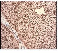 Immunohistochemistry (Formalin/PFA-fixed paraffin-embedded sections) - Anti-PABPN1 antibody [EP3001Y] - BSA and Azide free (AB284766)