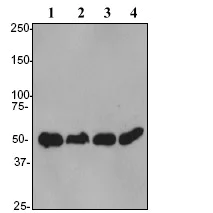 Western blot - Anti-PABPN1 antibody [EP3001Y] - BSA and Azide free (AB284766)