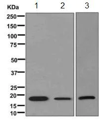 Western blot - Anti-PACAP antibody [EPR11543(B)] (AB170891)