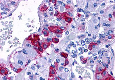 Immunohistochemistry (Formalin/PFA-fixed paraffin-embedded sections) - Anti-PACAP receptor/ADCYAP1R1 antibody (AB140703), expandable thumbnail