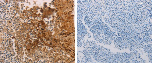 Immunohistochemistry (Formalin/PFA-fixed paraffin-embedded sections) - Anti-PACAP receptor/ADCYAP1R1 antibody (AB183103)