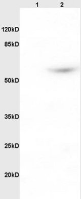 Western blot - Anti-PACAP receptor/ADCYAP1R1 antibody (AB216664), expandable thumbnail