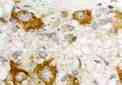Immunohistochemistry (Formalin/PFA-fixed paraffin-embedded sections) - Anti-PACAP receptor/ADCYAP1R1 antibody (AB28670)