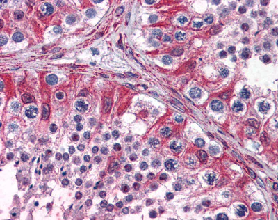 Immunohistochemistry (Formalin/PFA-fixed paraffin-embedded sections) - Anti-PACE4 antibody (AB110144)
