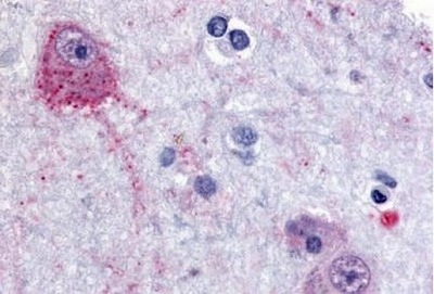 Immunohistochemistry (Formalin/PFA-fixed paraffin-embedded sections) - Anti-PACE4 antibody (AB140934), expandable thumbnail