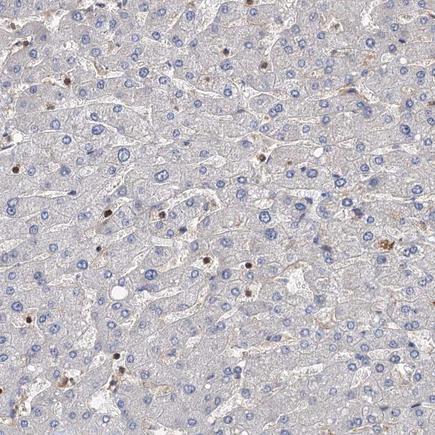 Immunohistochemistry (Formalin/PFA-fixed paraffin-embedded sections) - Anti-PACS1 antibody (AB243703)