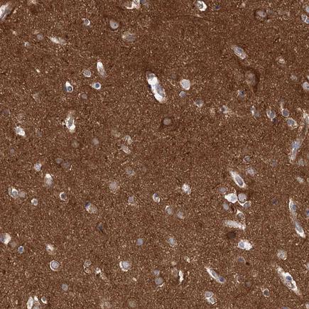 Immunohistochemistry (Formalin/PFA-fixed paraffin-embedded sections) - Anti-PACS1 antibody (AB243703)