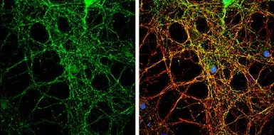 Immunocytochemistry/ Immunofluorescence - Anti-PACSIN1 antibody (AB137390)