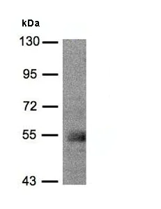 Western blot - Anti-PACSIN1 antibody (AB137390)