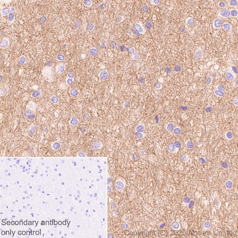Immunohistochemistry (Formalin/PFA-fixed paraffin-embedded sections) - Anti-PACSIN1 antibody [EPR29589-587] (ab323573), expandable thumbnail