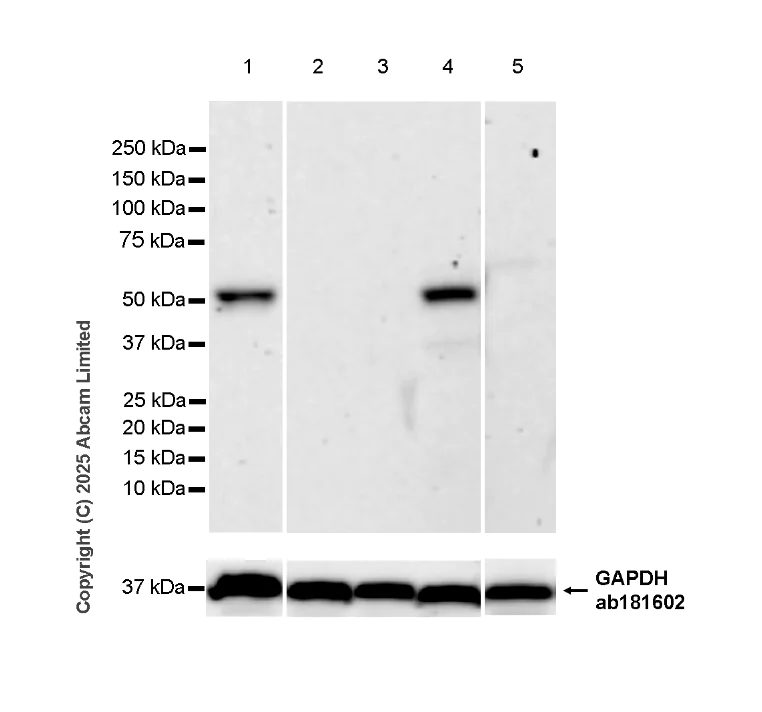 Western blot - Anti-PACSIN1 antibody [EPR29589-587] (AB323573)