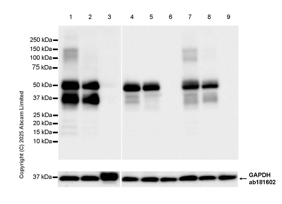 Western blot - Anti-PACSIN1 antibody [EPR29589-587] (AB323573), expandable thumbnail