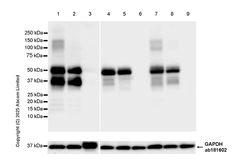 Western blot - Anti-PACSIN1 antibody [EPR29589-587] (AB323573)