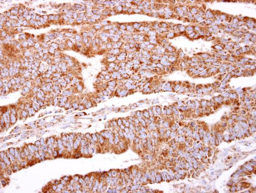 Immunohistochemistry (Formalin/PFA-fixed paraffin-embedded sections) - Anti-PACSIN2 antibody (AB228589)