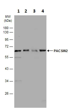 Western blot - Anti-PACSIN2 antibody (AB228589)