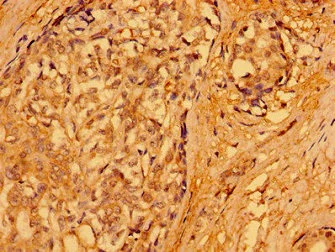 Immunohistochemistry (Formalin/PFA-fixed paraffin-embedded sections) - Anti-PACSIN3 antibody (AB235095)