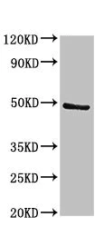 Western blot - Anti-PACSIN3 antibody (AB235095)