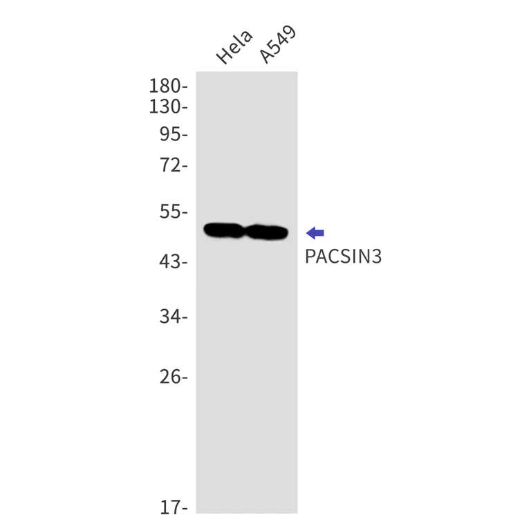 Western blot - Anti-PACSIN3 Antibody [S04-1F1] (AB317417)