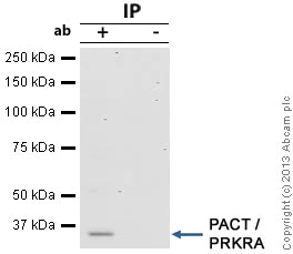 Immunoprecipitation - Anti-PACT (PKR activating protein) / PRKRA antibody (AB31967)