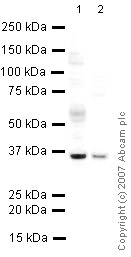 Western blot - Anti-PACT (PKR activating protein) / PRKRA antibody (AB31967)