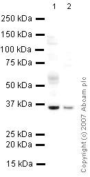 Western blot - Anti-PACT (PKR activating protein) / PRKRA antibody (AB31967)