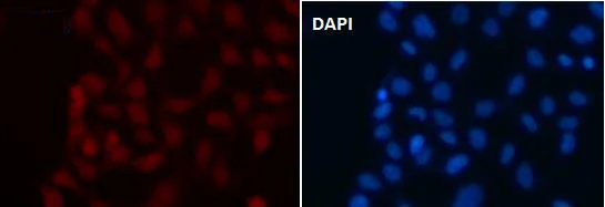 Immunocytochemistry/ Immunofluorescence - Anti-PACT (PKR activating protein) / PRKRA antibody [SR4053] (AB326703)